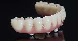 Implant retained denture prior to placement