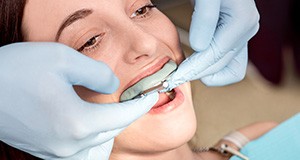 Woman being fitted for occlusal splint
