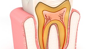 Animation of the inside of the tooth