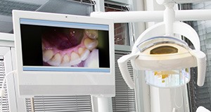 Intraoral photos on computer