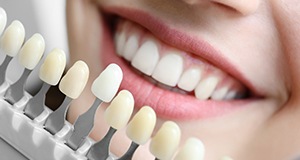 Tooth color matching guide